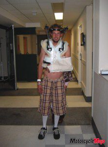 Example of a motorcycle injury Motorcycle helmet saved his life